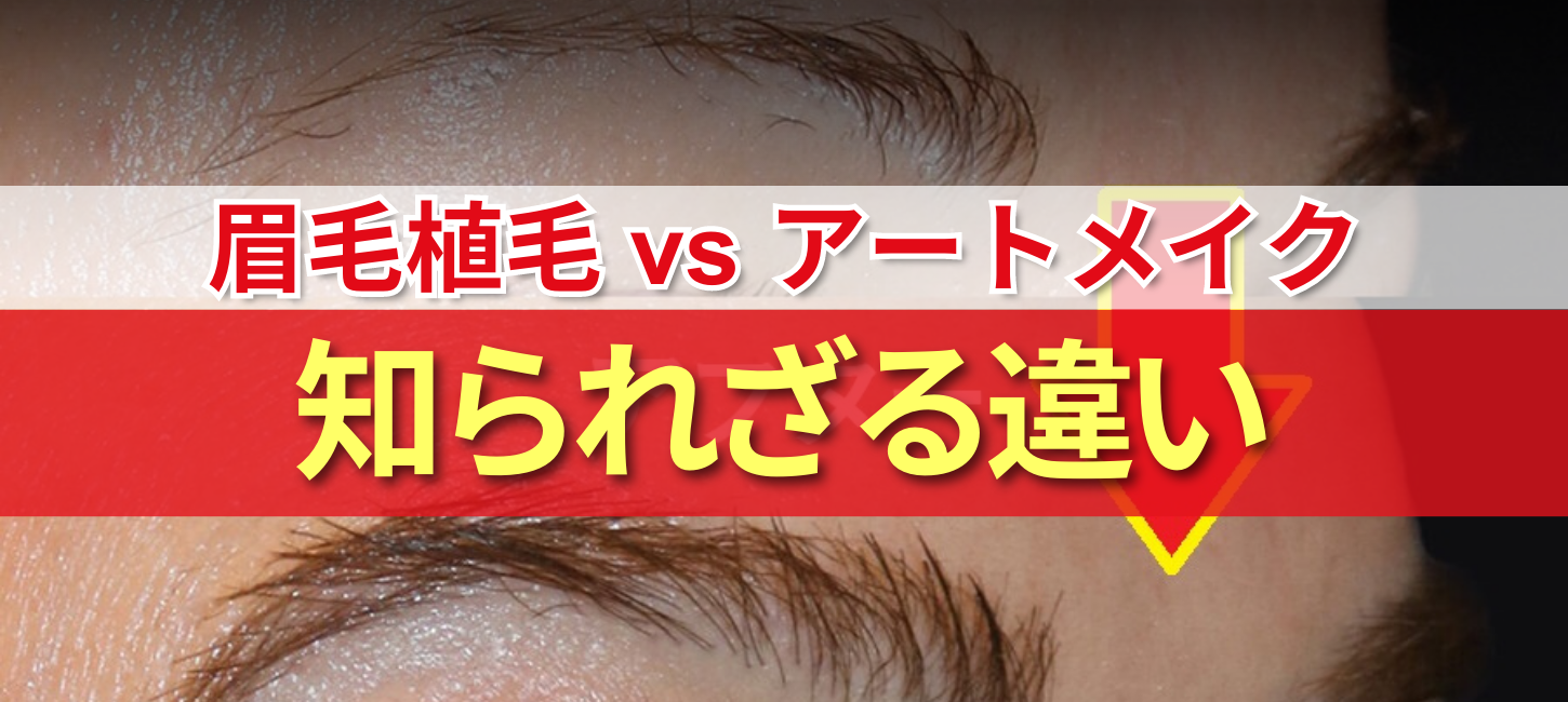 シリコーン製 ヘッド単品:髪の毛と眉毛と睫毛植毛式口可動MYDF 