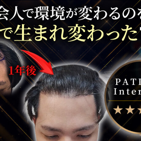新社会人の人生を変える最先端植毛！～これから新社会人になる九州出身
